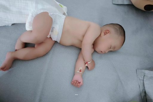 沙河宝宝脸上有白色斑块